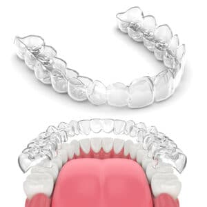 FRD-Invisalign-Model FRD-Invisalign-Model