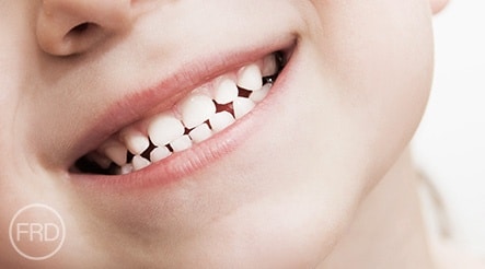 sedation dentistry for children