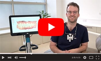 Invisalign by George Cheetham