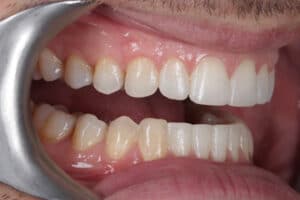 multi disciplinary smile solution two