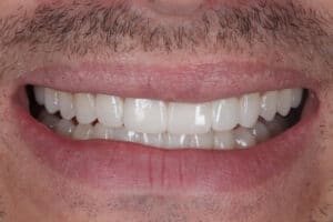 multi disciplinary smile solution