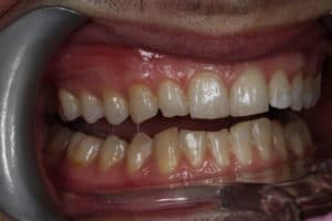 multi disciplinary smile solution four