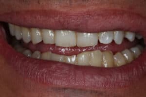 multi disciplinary smile solution three