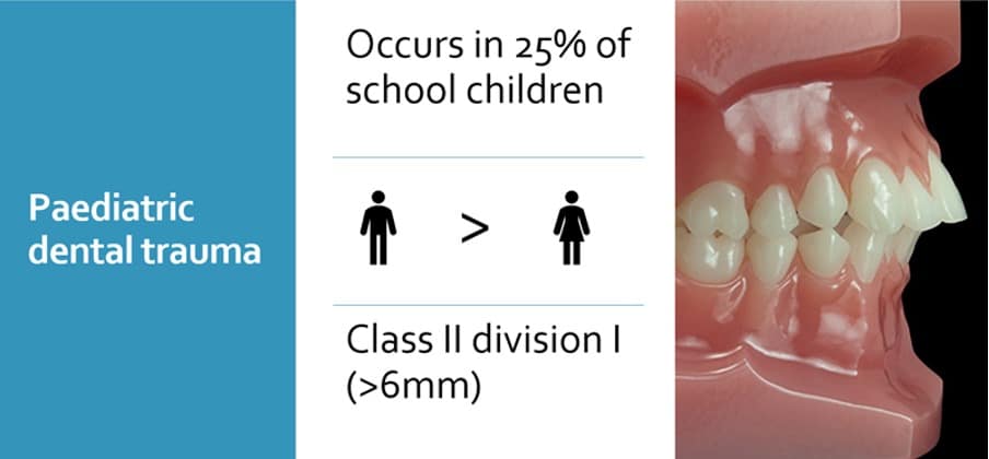Dental Trauma