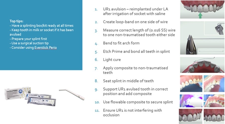 Luxation Splinting Types