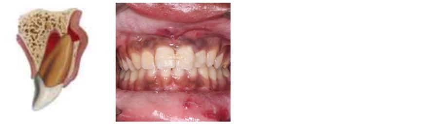 Luxation C3 Management