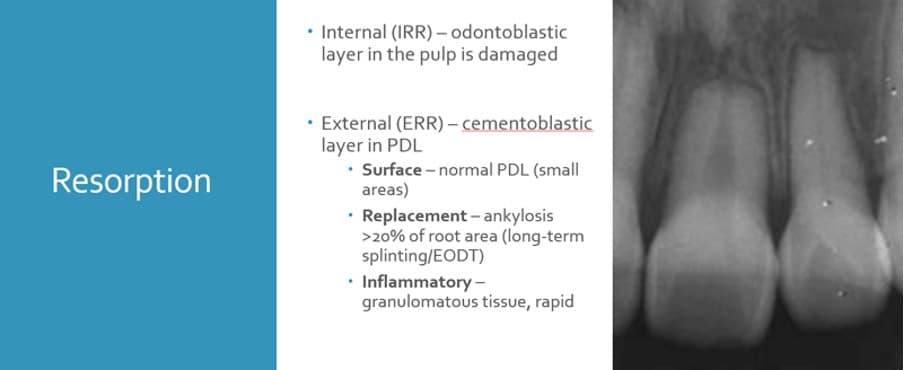 Resorption C3 Luxation