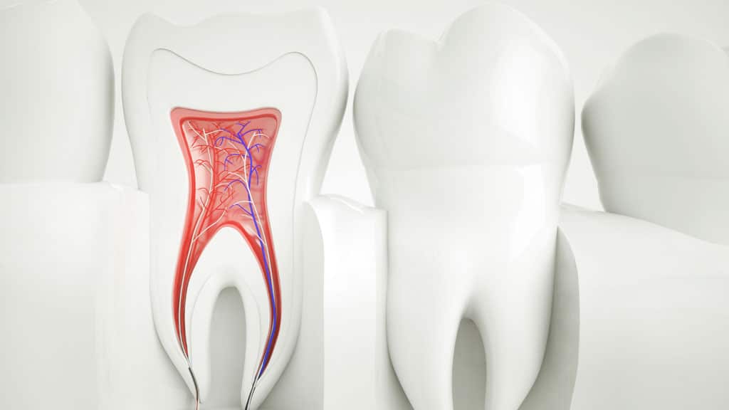 root canal treatment in fulham