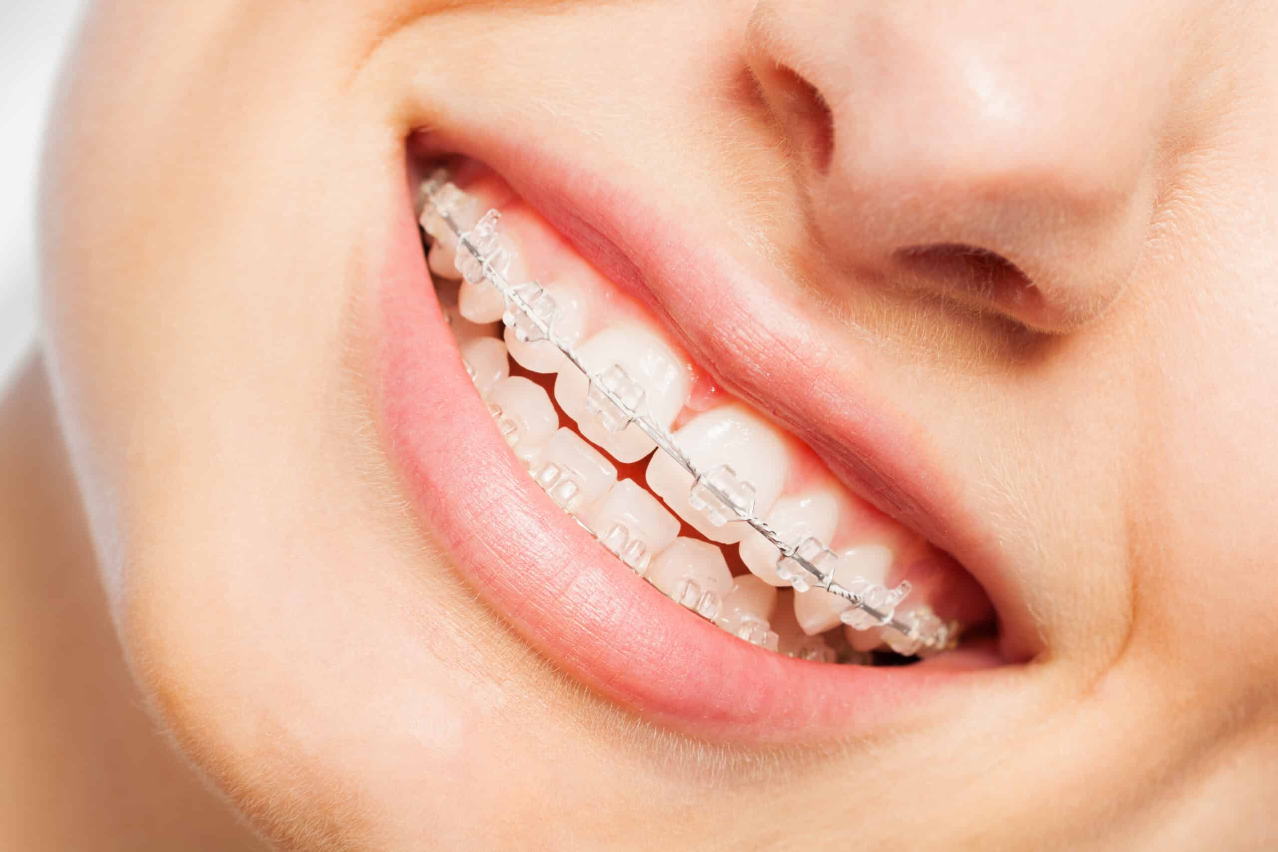fulham orthodontists experts