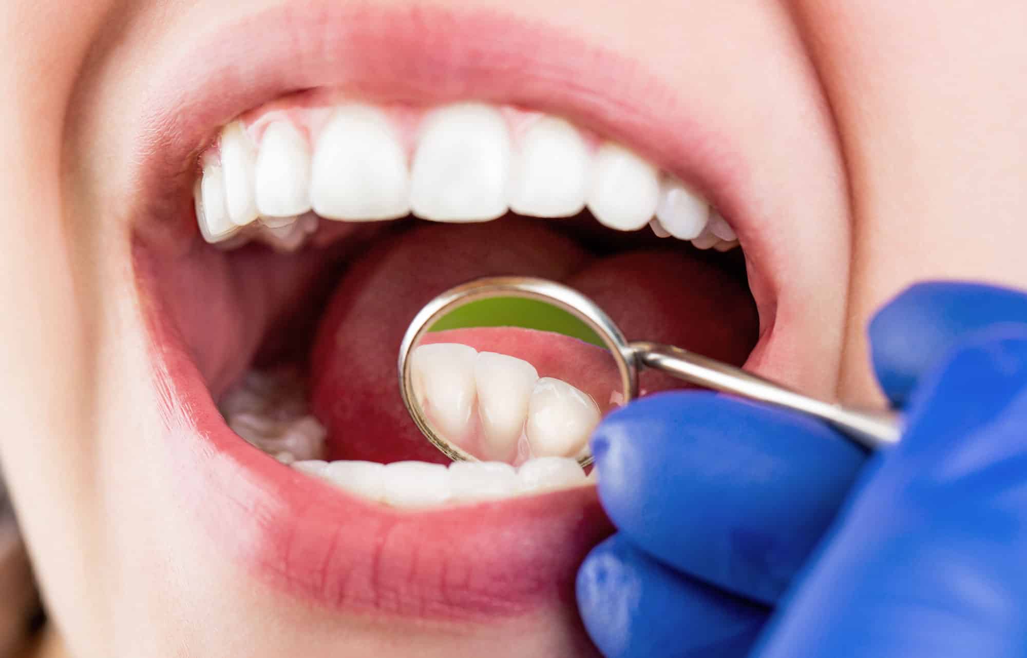 fulham general dentistry complete guide