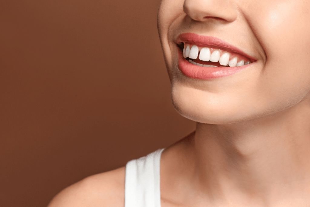 Gaps in Teeth - Fulham Road Dental