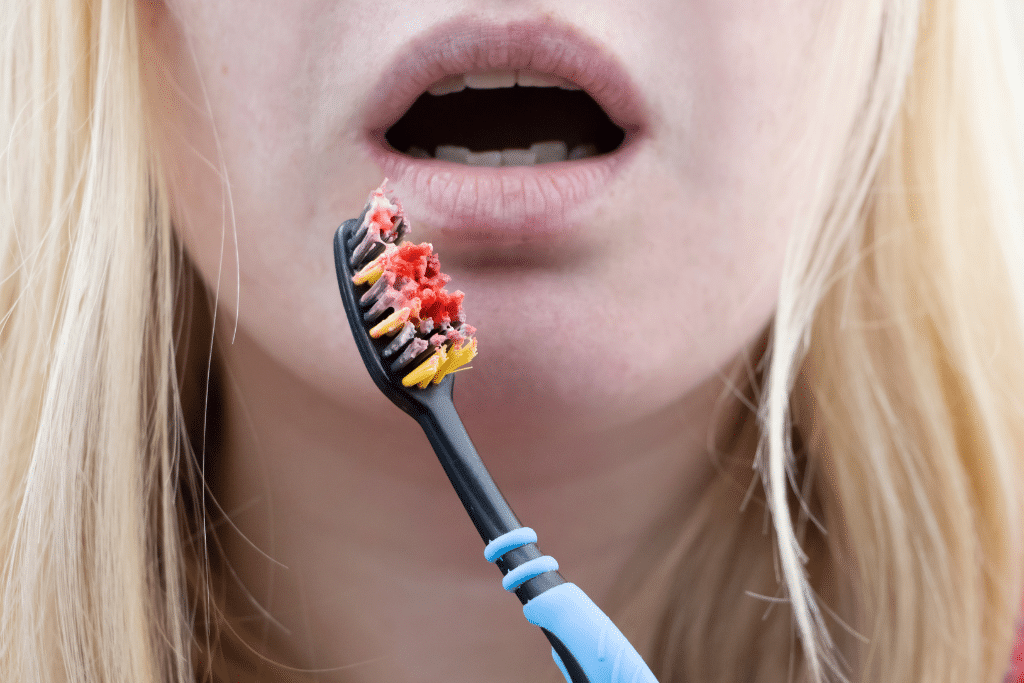 Periodontal Disease - Fulham Road Dental