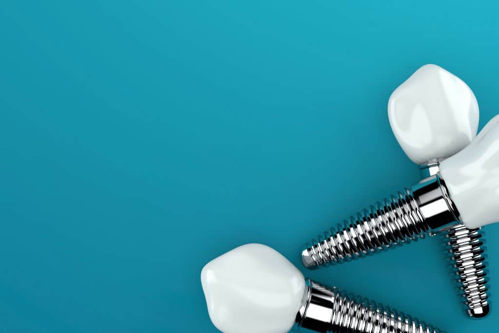 Dental Implants Near Me