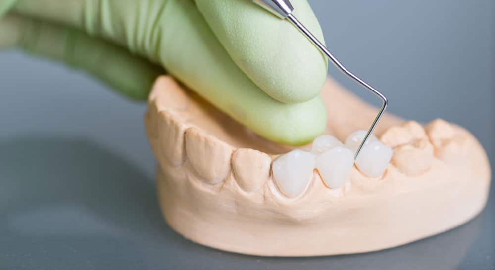 materials used for dental crowns materials used for dental crowns