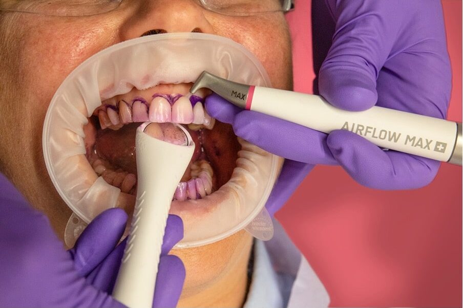 ems airflow max hygiene ems airflow max hygiene