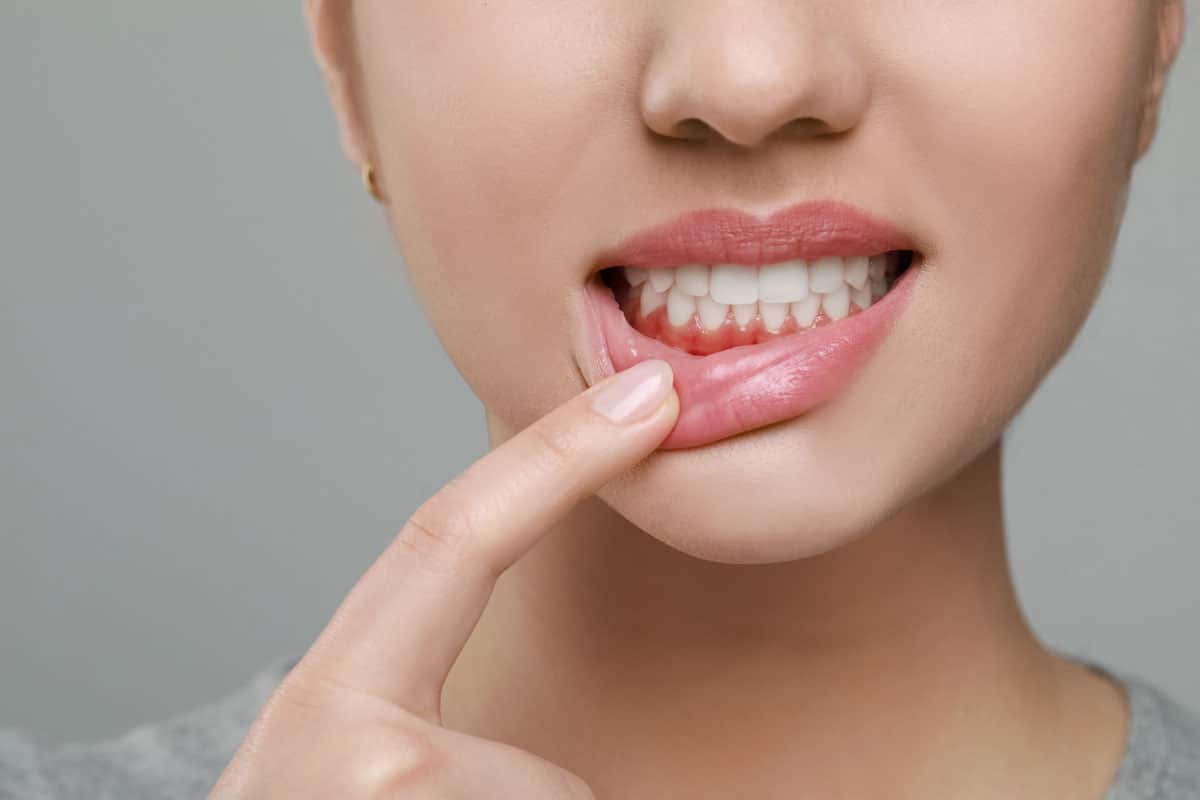 Treatments for mouth infections Treatments for mouth infections