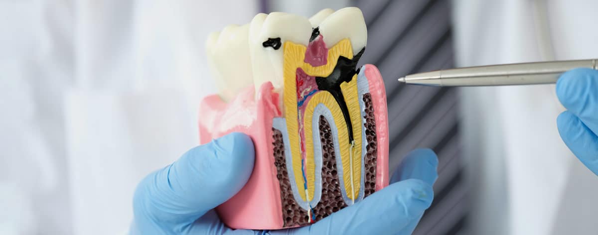 Common causes of toothaches that require professional treatment Common causes of toothaches that require professional treatment