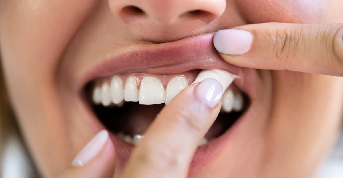 Tobacco and your teeth Tobacco and your teeth