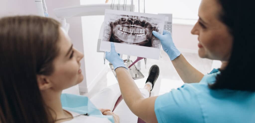 Traditional filling options