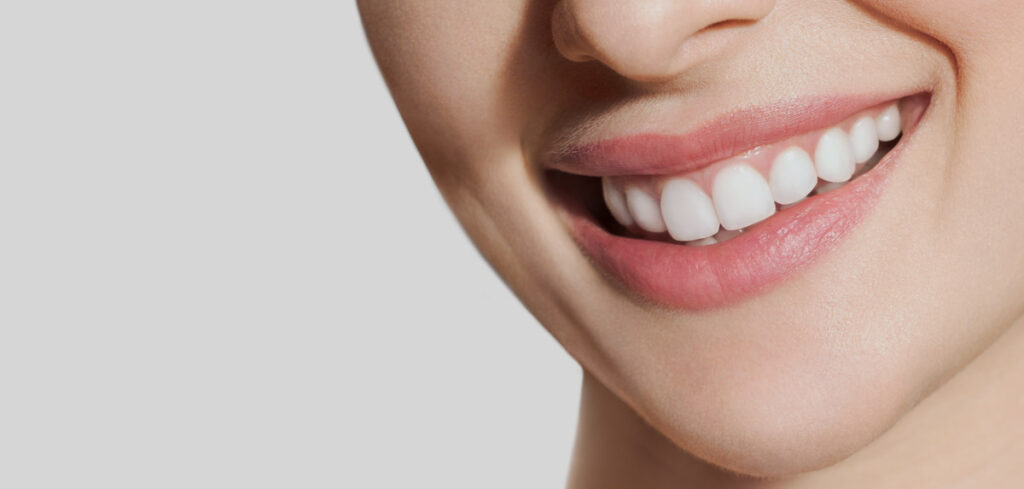 woman smiling teeth whitening